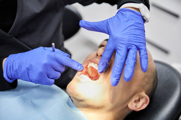 Best Emergency Treatment for Dental Infections or Abscesses in Duluth, MN