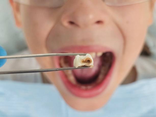 Best Pediatric Emergency Dentist in Duluth, MN