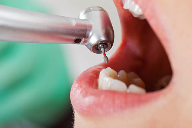 Best Emergency Gum Treatment in Duluth, MN